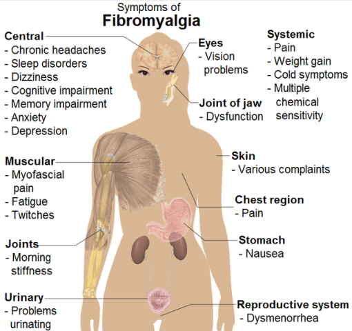 What Are the Symptoms of Fibromyalgia