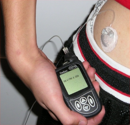 File:Insulin pump with infusion set.jpg - Wikimedia Commons
